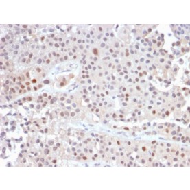 p21WAF1 (Tumor Suppressor Protein)(CIP1/2489R), Biotin conjugate, 0.1mg/mL