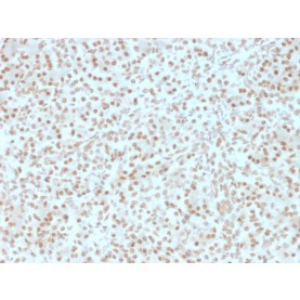 Biotium BNCB2491-100, AKT1 (Prognostic Marker for Neuroendocrine Tumors)(AKT1/2491), Biotin conjugate, 0.1mg/mL