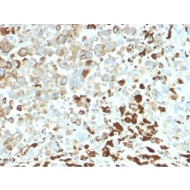 NGF-Receptor (p75) / CD271 (Soft Tissue Tumor Marker) (NGFR/2550R), Biotin conjugate, 0.1mg/mL