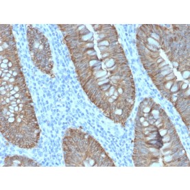 Ep-CAM / CD326 (Extracellular Domain) (Epithelial Marker)(EGP40/2571R), Biotin conjugate, 0.1mg/mL