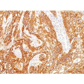 EGFRvIII (Epidermal Growth Factor Receptor, Variant III) (GFR/2600R), Biotin conjugate, 0.1mg/mL