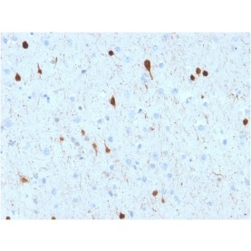 Biotium BNCB2602-100, Calretinin / Calbindin 2 (Mesothelioma Marker)(CALB2/2602), Biotin conjugate, 0.1mg/mL