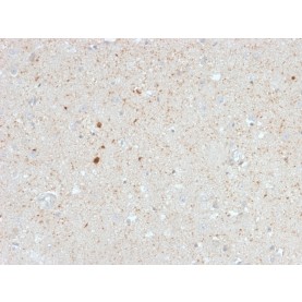 Biotium BNCB2603-100, Calretinin / Calbindin 2 (Mesothelioma Marker)(CALB2/2603), Biotin conjugate, 0.1mg/mL