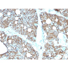 Biotium BNCB2616-500, Cadherin 17 / LI Cadherin (Liver-Intestine Marker)(CDH17/2616), Biotin conjugate, 0.1mg/mL