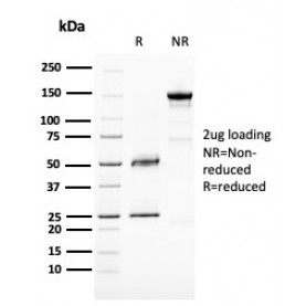 Biotium BNCB2667-100, BAP1 (BRCA1 Associated Protein 1)(BAP1/2667), Biotin conjugate, 0.1mg/mL
