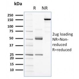 Biotium BNCB2672-500, CD117 / c-Kit (Marker for Gastrointestinal Stromal Tumors)(KIT/2672), Biotin conjugate, 0.1mg/mL