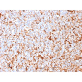 Mammaglobin (SCGB2A2) (Breast Cancer Marker)(MGB1/2682R), Biotin conjugate, 0.1mg/mL