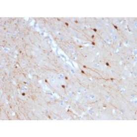 Biotium BNCB2685-100, Calretinin / Calbindin 2 (Mesothelioma Marker)(CALB2/2685), Biotin conjugate, 0.1mg/mL