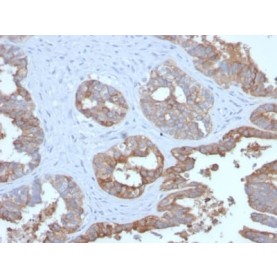 MUC1 / CA15-3 / EMA / CD227 (Epithelial Marker) (MUC1/2729R), Biotin conjugate, 0.1mg/mL