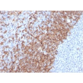 Human IgD (Immunoglobulin Delta Heavy Chain) (B-Cell Marker) (IGHD/2730R), Biotin conjugate, 0.1mg/mL