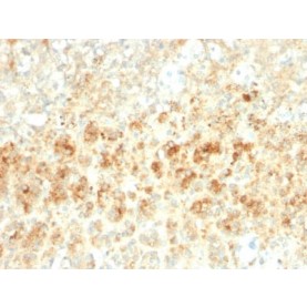 Biotium BNCB2755-100, Adipophilin / Perilipin-2 (Marker of Lipid Accumulation) (ADFP/2755R), Biotin conjugate, 0.1mg/mL