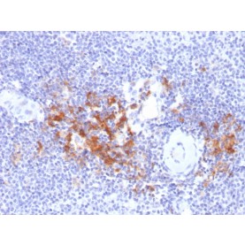 TRAF1 (TNFR-Associated Factor 1) (Lymphomatoid Papulosis Marker)(TRAF1/2770), Biotin conjugate, 0.1mg/mL