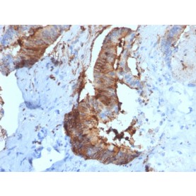 Biotium BNCB2781-100, Cathepsin D (Tumor Marker)(CTSD/2781), Biotin conjugate, 0.1mg/mL