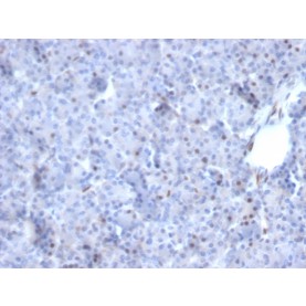 Biotium BNCB2784-100, AKT1 (Prognostic Marker for Neuroendocrine Tumors)(AKT1/2784), Biotin conjugate, 0.1mg/mL
