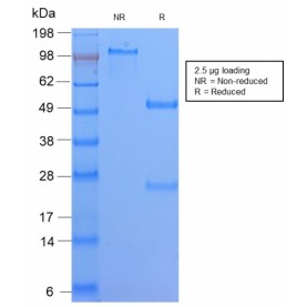 HLA-DQ (MHC II)(HLA-DQA1/2866R), Biotin conjugate, 0.1mg/mL