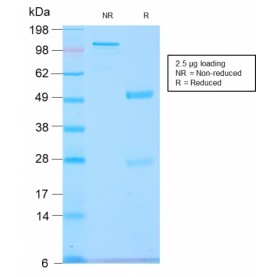 GnRH-Receptor / LH-RH Receptor(GNRHR/2982R), Biotin conjugate, 0.1mg/mL
