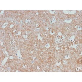 Neurofilament (NF-L) (Neuronal Marker) (NEFL/2983R), Biotin conjugate, 0.1mg/mL