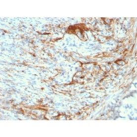 Elastin (ELN) (Marker of Arterial Stiffness and Atherosclerosis)(ELN/3131R), Biotin conjugate, 0.1mg/mL