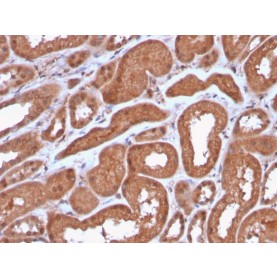 MTAP (Tumor Suppressor Marker)(MTAP/3137R), Biotin conjugate, 0.1mg/mL