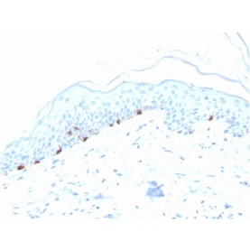 Tyrosinase-Related Protein-1 (TYRP-1) (Melanoma Marker)(TYRP1/3280), Biotin conjugate, 0.1mg/mL