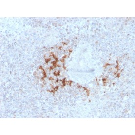 TRAF1 (TNFR-Associated Factor 1) (Lymphomatoid Papulosis Marker)(TRAF1/3298), Biotin conjugate, 0.1mg/mL