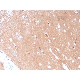 Tubulin beta 3 / TUBB3 (Neuronal & Stem Cell Marker)(TUBB3/3731), Biotin conjugate, 0.1mg/mL