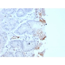 von Willebrand Factor / Factor VIII Related-Ag (Endothelial Marker)(rVWF/2480), 0.2mg/mL