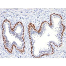 p63 (Squamous, Basal & Myoepithelial Cell Marker)(TP63/11), 1mg/mL