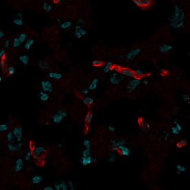 CD31 / PECAM-1(C31.7), 1mg/mL
