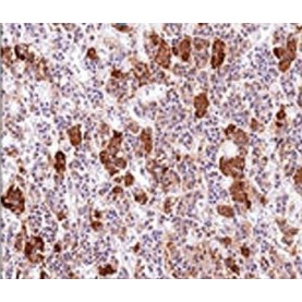 ACTH (Adrenocorticotrophic Hormone)(AH26), 1mg/mL