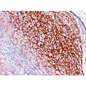 CD35 / CR1(E11), 1mg/mL