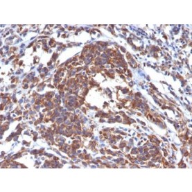 Vimentin(LN-6), 1mg/mL