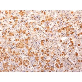 ACTH (Adrenocorticotrophic Hormone)(57), 1mg/mL