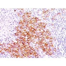 CD30(CD30/412), 1mg/mL
