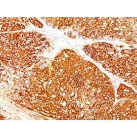 Melanoma Marker(HMB45 + A103 + T311), 1mg/mL