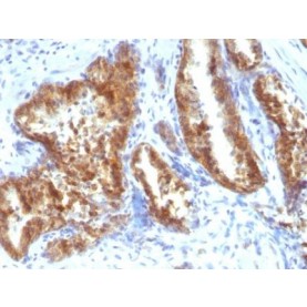 AMACR / p504S(Rabbit PAb), 1mg/mL
