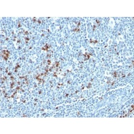 Human Kappa Light Chain(HP6053 + L1C1), 1mg/mL