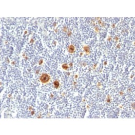 CD30(Ki-1/779), 1mg/mL
