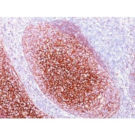 CD35 / CR1(CR1/802), 1mg/mL
