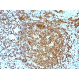 CD45RA(PTPRC/818), 1mg/mL
