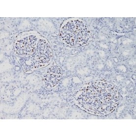 WT1 (Wilm's Tumor 1)(WT1/857), 1mg/mL