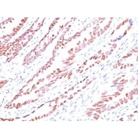 p57 / KIP2(KP10), 1mg/mL
