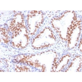 Androgen Receptor(DHTR/882), 1mg/mL