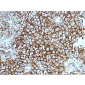 Melanoma Marker(KBA.62), 1mg/mL