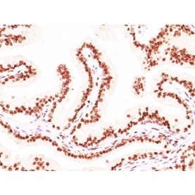 Androgen Receptor(AR441 + DHTR/882), 1mg/mL
