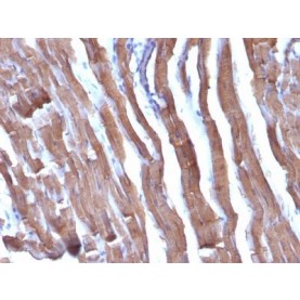 Actin, Muscle Specific (Muscle Cell Marker)(HHF35 + MSA/953), 1mg/mL