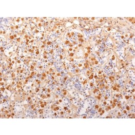 ACTH (Adrenocorticotrophic Hormone)(2F6), 1mg/mL