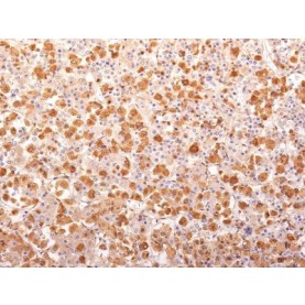 ACTH (Adrenocorticotrophic Hormone)(AH26 + 57), 1mg/mL