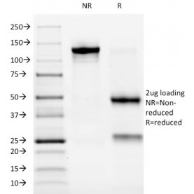 Biotium BNUM1032-50, ALK (Anaplastic Lymphoma Kinase) / CD246(ALK/1032), 1mg/mL