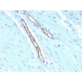 Blood Group Antigen A(HE-193), 1mg/mL